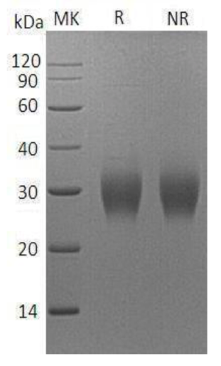 Recombinant Human Fibrillin-1/Asprosin (N-8His)